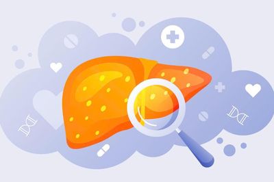 Tăng cường khả năng phát hiện sớm viêm gan B và mở rộng đối tượng được tiếp cận y tế