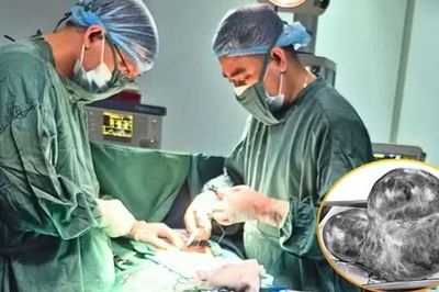 Bụng phình to bất thường, sự thật bác sĩ nói ra khiến người phụ nữ sốc nặng