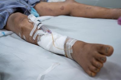 Vết trầy nhỏ khiến người đàn ông tiên lượng rất cao không qua khỏi