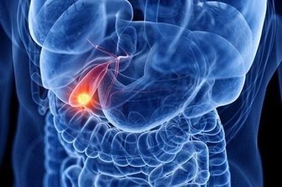 Bất ngờ nhận chẩn đoán ung thư giai đoạn cuối dù ăn ngon, ngủ tốt