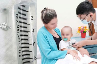 Gắp kim băng khỏi thực quản bé 9 tháng tuổi