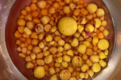 Phẫu thuật lấy thành công hơn 100 viên sỏi ra khỏi bàng quang cho cụ ông 80 tuổi