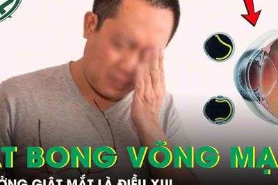 Giật mắt phải tưởng điềm xui, người đàn ông tự tát bong võng mạc, suýt mù mắt
