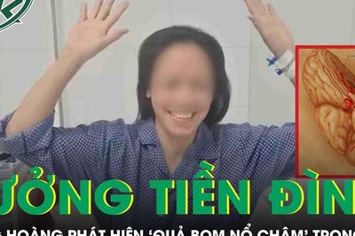 Đau đầu tưởng tiền đình, người phụ nữ bàng hoàng phát hiện 'quả bom nổ chậm' trong não