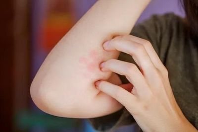 Codex ban hành hướng dẫn mới về nhãn thực phẩm cảnh báo dị ứng