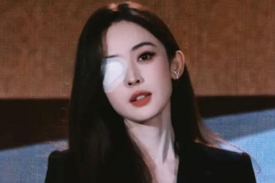 Cổ Lực Na Trát khiến fan lo lắng vì băng kín một bên mắt tại sự kiện
