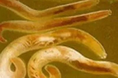Phát hiện 2 lượt dương tính với giun đầu gai ở Khánh Hòa, bác sĩ cảnh báo nguy cơ từ món ăn khoái khẩu