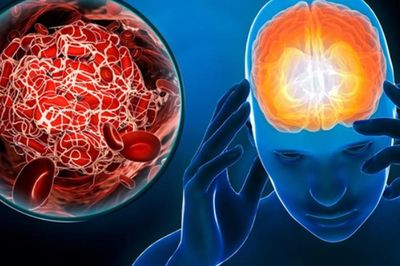Tự ý bỏ thuốc tiểu đường, ăn kiêng, người đàn ông hôn mê vì hạ đường huyết, triệu chứng giống đột quỵ