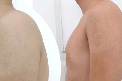 Cổ rụt, lưng gù vì ngồi học vẹo vọ, bò ra bàn