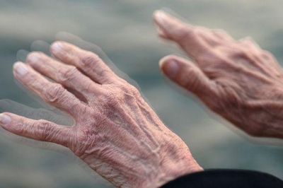 Triển vọng theo dõi Parkinson và các rối loạn thần kinh bằng phương pháp không xâm lấn