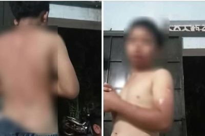 Đắk Lắk: Làm rõ việc bé trai bị mẹ ruột tạt nước sôi gây bỏng