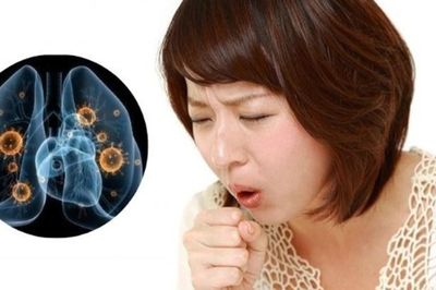 Bệnh lao âm thầm gia tăng, bác sĩ khuyến cáo người trẻ không nên chủ quan