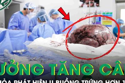 Tưởng tăng cân, nữ sinh 17 tuổi phát hiện khối u buồng trứng nặng hơn 10kg