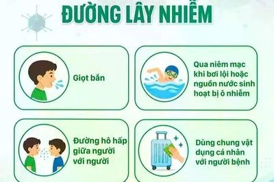 Số ca nhiễm Adenovirus tăng chóng mặt, nguy cơ lây lan trong mùa hè