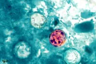 Ký sinh trùng Cyclospora là gì và vì sao đang gây lo ngại tại Mỹ?