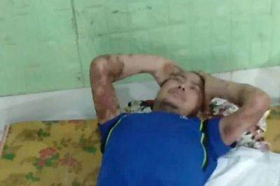 Mở rộng lòng từ: Người đàn ông mắc nhiều bệnh