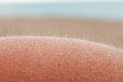 Giải mã bí ẩn trăm năm về lông tơ giúp trị chứng ngứa
