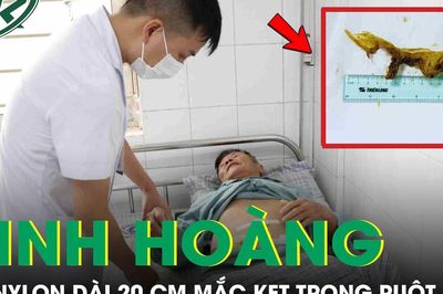 Kinh hoàng: Túi nilon dài 20 cm mắc kẹt trong ruột bệnh nhân