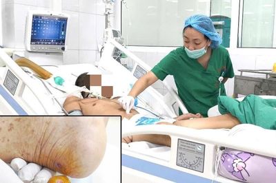 Gà mổ vào gót chân khiến cụ ông nguy kịch