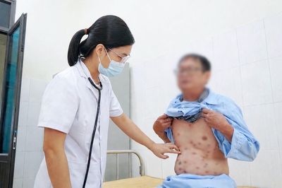 Một dấu hiệu kéo dài không khỏi, đi khám ra đái tháo đường