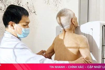 Phát hiện 3 trường hợp mắc lao phổi nghi do hút thuốc lá