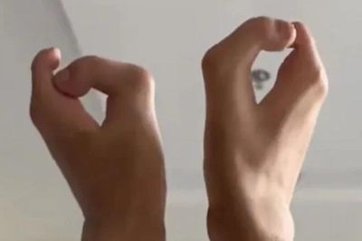 Người đàn ông có bàn chân 'móng bò' và sự thật bất ngờ
