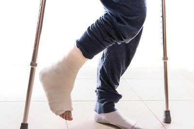 Lưu ý khi phục hồi chức năng sau gãy xương