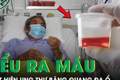 Phát hiện ung thư bàng quang đa ổ từ dấu hiệu tiểu ra máu