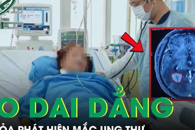 Người phụ nữ tá hỏa phát hiện mắc ung thư từ dấu hiệu ho dai dẳng