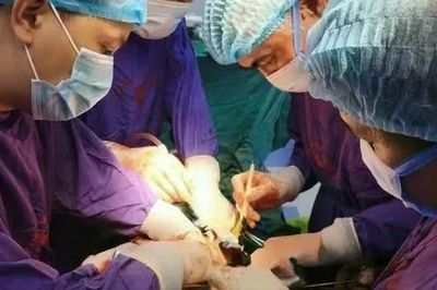 Phẫu thuật thành công khối u gan nặng 3,5 kg sau 2 năm tự dùng thuốc nam