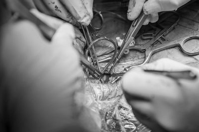 Phẫu thuật hẹp động mạch cảnh với bệnh nhân tỉnh: Cuộc đối thoại đặc biệt để bảo vệ não