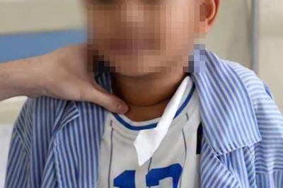 Bé 8 tuổi mắc ung thư tuyến giáp từ dấu hiệu rất dễ bị bỏ qua