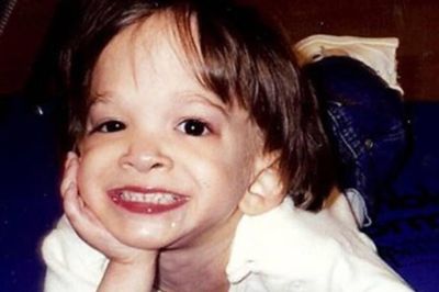 Cô gái 20 tuổi mãi mang hình hài trẻ lên 2, bí ẩn y học kỳ lạ bậc nhất thế giới