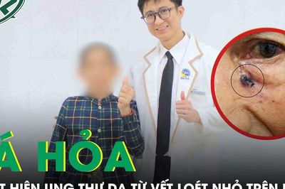 Tá hỏa phát hiện ung thư da từ vết loét nhỏ trên mặt