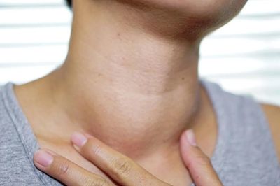 Bác sĩ cảnh báo 5 nhóm người dễ mắc một loại ung thư phổ biến