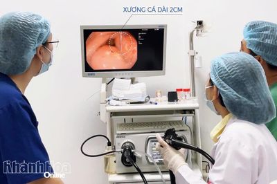 Bệnh viện 22-12 kịp thời gắp dị vật xương cá cắm vào dạ dày bệnh nhân
