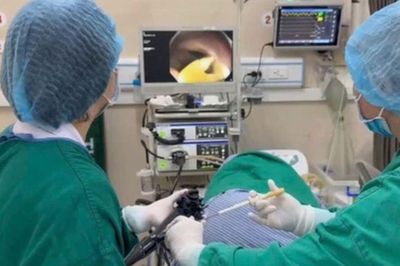 Thích ăn phở bò tái suốt nhiều năm, người đàn ông đi khám rồi bàng hoàng khi bác sĩ gắp ra con sán dài 1,2 mét