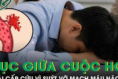 Nam thanh niên 29 tuổi bất ngờ gục giữa cuộc họp giao ban sáng, suýt vỡ mạch máu não