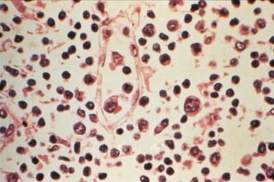 Virus Hanta: Tăng cường vệ sinh phòng ngừa nguy cơ lây nhiễm từ chuột