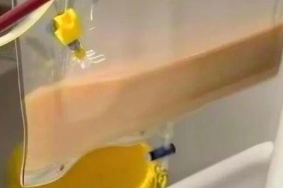 Người đàn ông 40 tuổi có 'máu trắng đục như sữa', bác sĩ cảnh báo thói quen 'sướng miệng, hại thân'
