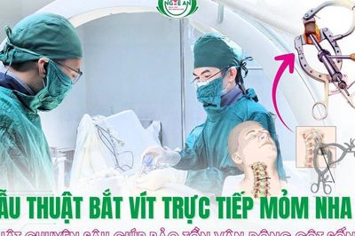 Bệnh viện HNĐK Nghệ An làm chủ kỹ thuật bắt vít trực tiếp mỏm nha C2, bảo tồn vận động cột sống cổ