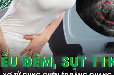 Người phụ nữ tiểu đêm liên tục, sụt 11kg vì khối u xơ tử cung chèn ép bàng quang