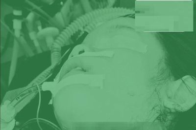 Bé gái 5 tuổi bị mảnh tô vỡ cứa sâu sát khí quản trong tai nạn khi ăn cơm