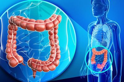 Ai có nguy cơ cao mắc ung thư đại trực tràng?