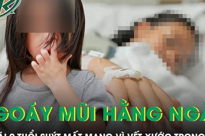 Bé gái 9 tuổi suýt mất mạng vì thói quen ngoáy mũi nhiều người vẫn làm mỗi ngày