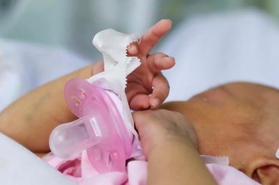 Em bé chào đời với một phần trái tim bên ngoài cơ thể