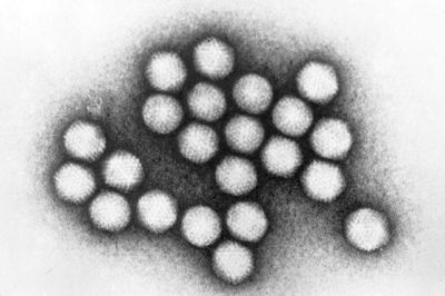 12 trẻ nhập viện vì Adenovirus, phụ huynh cần lưu ý dấu hiệu này