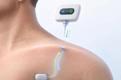 Phát triển thành công ổ cắm sinh học dưới da, sạc pin thiết bị y tế chỉ bằng một lần đâm kim