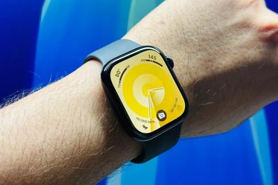 Đừng chờ Apple Watch đột phá