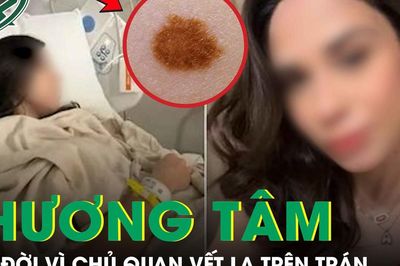 Cô gái 26 tuổi qua đời thương tâm vì chủ quan vết lạ trên trán